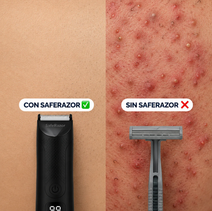 SafeRazor™ - Rasúrate abajo en la ducha en 3 minutos. Sin sangre. Sin desorden.