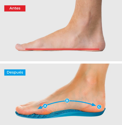 Plantillas ComfyFeet™️ - Disfruta de días sin dolor, sin tratamientos caros ni visitas al médico....