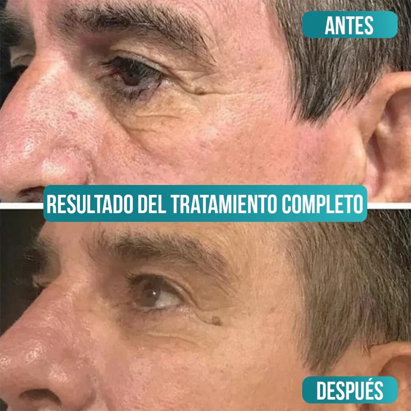 Veze Men - Crema Antiedad para Hombres - Compra 1 y llévate 2