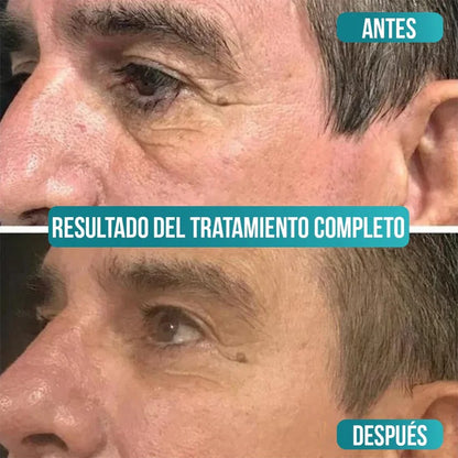 Veze Men - Crema Antiedad para Hombres - Compra 1 y llévate 2